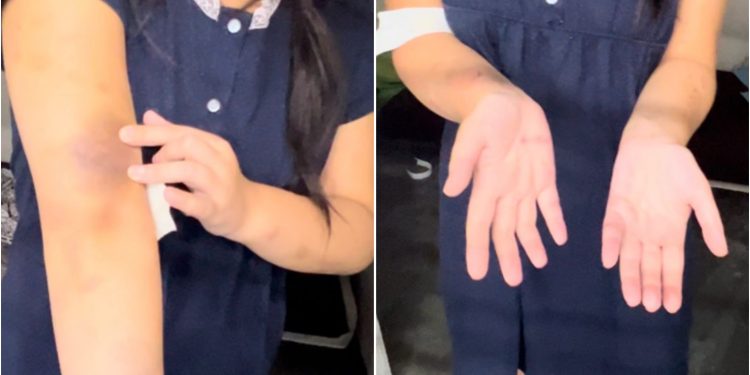 Jovem que matou a mãe alega legítima defesa e diz que foi eletrocutada