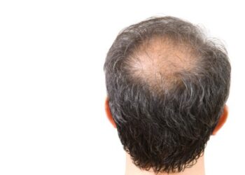 Homem calvo pede para usar boné em prédios públicos e tem pedido negado pela Justiça