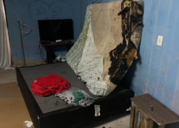 Adolescente de 17 anos fica com 40% do corpo queimado após namorado atear fogo nela