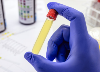 CONTRAN prorroga prazo de exame toxicológico para motoristas profissionais