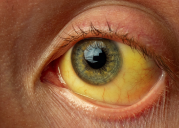 Com aumento de casos de hepatite A, Saúde de Curitiba orienta para prevenção da doença