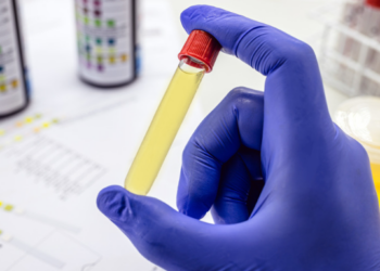 Justiça condena laboratório por resultado falso positivo em exame toxicológico de motorista