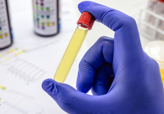 Justiça condena laboratório por resultado falso positivo em exame toxicológico de motorista