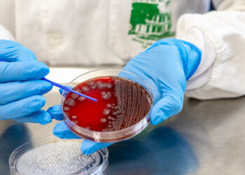 Doenças gastrointestinais: com 389 mil casos neste ano, Saúde alerta para ações de prevenção