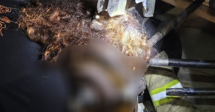 Equipe realiza resgate complexo de mulher que ficou com couro cabeludo preso em semieixo de carro