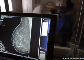 Ministério da Saúde passa a recomendar mamografia a partir dos 40 anos