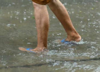 Saúde alerta: leptospirose é doença grave e risco aumenta após chuvas